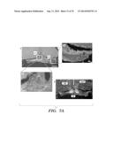 CO-ACTIVATION OF MTOR AND STAT3 PATHWAYS TO PROMOTE NEURONAL SURVIVAL AND     REGENERATION diagram and image