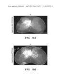 CO-ACTIVATION OF MTOR AND STAT3 PATHWAYS TO PROMOTE NEURONAL SURVIVAL AND     REGENERATION diagram and image