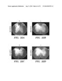 CO-ACTIVATION OF MTOR AND STAT3 PATHWAYS TO PROMOTE NEURONAL SURVIVAL AND     REGENERATION diagram and image