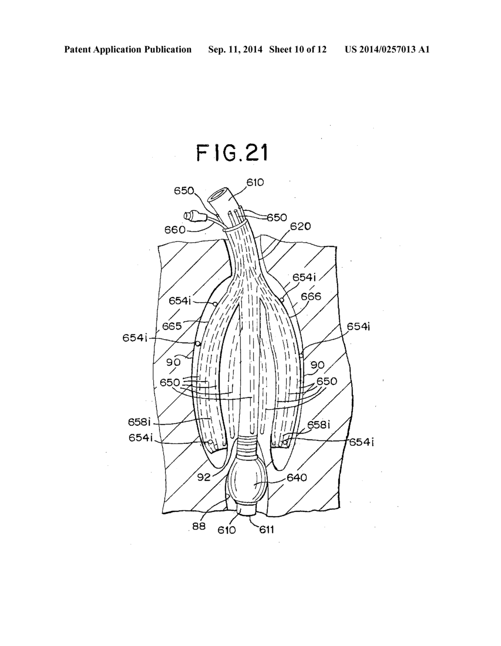 BRACHYTHERAPY DEVICES AND METHODS FOR THERAPEUTIC RADIATION PROCEDURES - diagram, schematic, and image 11