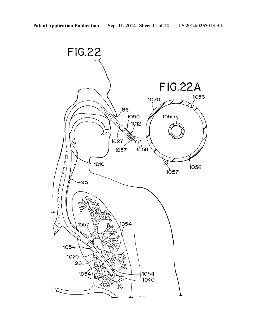 BRACHYTHERAPY DEVICES AND METHODS FOR THERAPEUTIC RADIATION PROCEDURES - diagram, schematic, and image 12