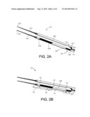 INCONTINENCE IMPLANT ASSEMBLY diagram and image