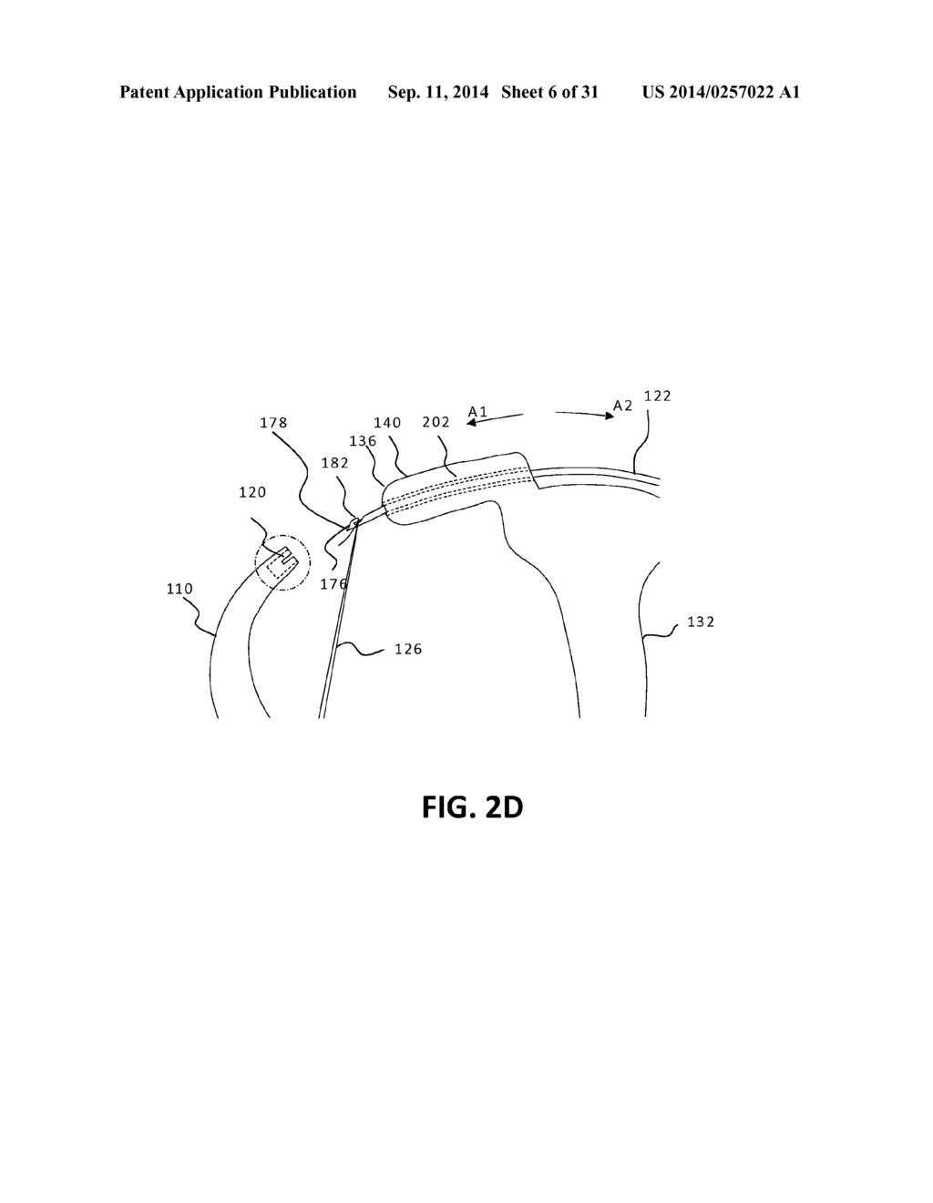 DEVICES FOR DELIVERING IMPLANTS - diagram, schematic, and image 07