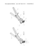 RETRACTOR diagram and image