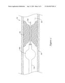 KERSTPIEK TIP FOR MEDICAL DEVICES diagram and image