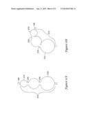 KERSTPIEK TIP FOR MEDICAL DEVICES diagram and image