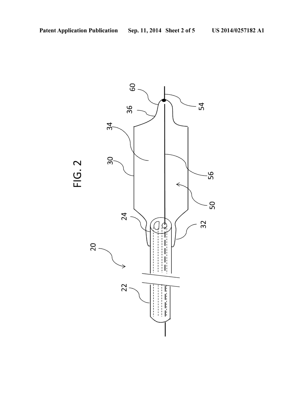 SYSTEM FOR A WIRE-LUMEN FREE BALOON CATHETER - diagram, schematic, and image 03