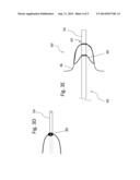 SYSTEM FOR A WIRE-LUMEN FREE BALOON CATHETER diagram and image