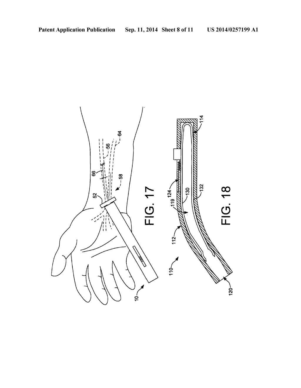 MEDICAL APPARATUS FACILITATING VASCULAR ANALYSIS AND TREATMENT - diagram, schematic, and image 09