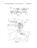 SYSTEMS AND PROCESSES FOR EYE MOISTURIZING DURING OCULAR SURGERY diagram and image