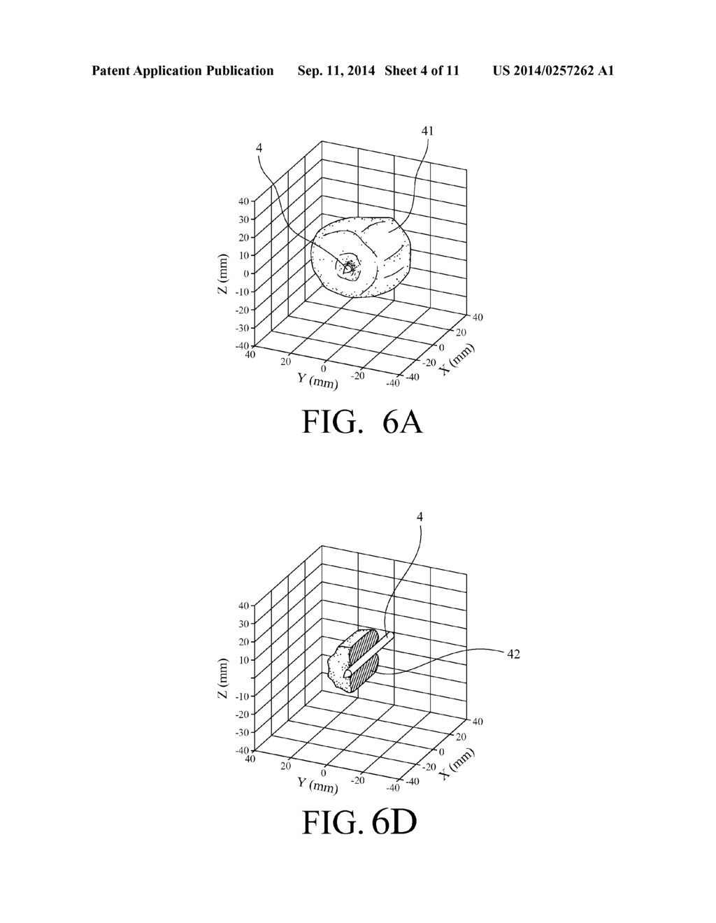 INTERSTITIAL ULTRASONIC DISPOSABLE APPLICATOR AND METHOD FOR TISSUE     THERMAL CONFORMAL VOLUME ABLATION AND MONITORING THE SAME - diagram, schematic, and image 05