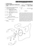 Patient-Specific Glenoid Guide With a Reusable Guide Holder diagram and image