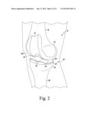 CUSTOMIZED PATIENT-SPECIFIC REVISION SURGICAL INSTRUMENTS AND METHOD diagram and image