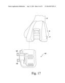 CUSTOMIZED PATIENT-SPECIFIC REVISION SURGICAL INSTRUMENTS AND METHOD diagram and image