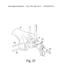 CUSTOMIZED PATIENT-SPECIFIC REVISION SURGICAL INSTRUMENTS AND METHOD diagram and image