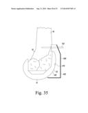 CUSTOMIZED PATIENT-SPECIFIC REVISION SURGICAL INSTRUMENTS AND METHOD diagram and image