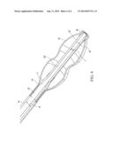 LOW COST INFLATABLE BONE TAMP diagram and image