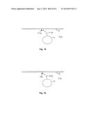 Implantable Device With Adhesive Properties diagram and image