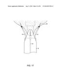 METHODS AND DEVICES FOR MANIPULATING AND FASTENING TISSUE diagram and image