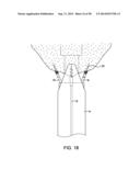 METHODS AND DEVICES FOR MANIPULATING AND FASTENING TISSUE diagram and image