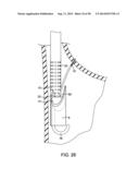 METHODS AND DEVICES FOR MANIPULATING AND FASTENING TISSUE diagram and image