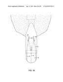 METHODS AND DEVICES FOR MANIPULATING AND FASTENING TISSUE diagram and image