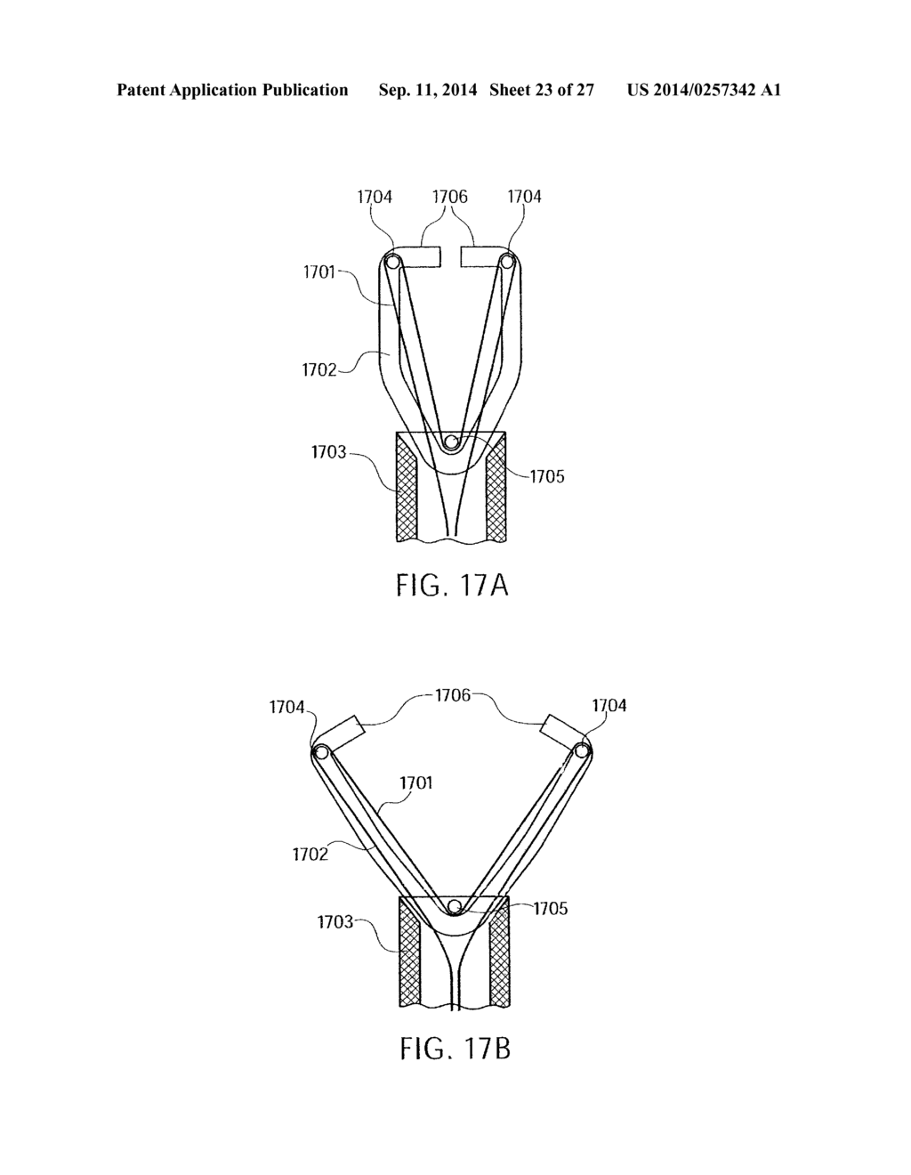 Device and Method for Through the Scope Endoscopic Hemostatic Clipping - diagram, schematic, and image 24