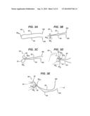 Implant Having Adjustable Filament Coils diagram and image