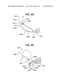 Implant Having Adjustable Filament Coils diagram and image