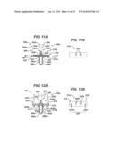 Implant Having Adjustable Filament Coils diagram and image