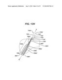 Implant Having Adjustable Filament Coils diagram and image