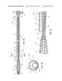 TEMPORARY SEALING DEVICE WITH BLOOD FLASHBACK FOR VESSEL LOCATION diagram and image