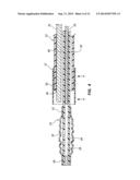 TEMPORARY SEALING DEVICE WITH BLOOD FLASHBACK FOR VESSEL LOCATION diagram and image