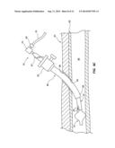 TEMPORARY SEALING DEVICE WITH BLOOD FLASHBACK FOR VESSEL LOCATION diagram and image