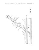 TEMPORARY SEALING DEVICE WITH BLOOD FLASHBACK FOR VESSEL LOCATION diagram and image