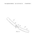 PERCUTANEOUS BREAK OFF ROD diagram and image