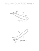 PERCUTANEOUS BREAK OFF ROD diagram and image