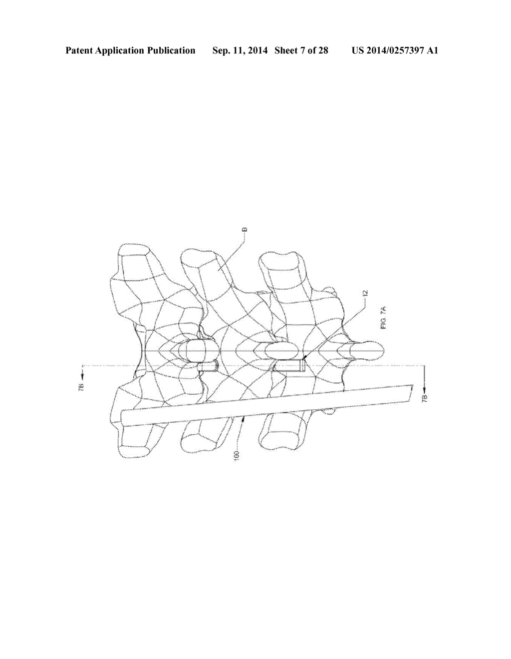 FLEXIBLE FASTENING SYSTEM - diagram, schematic, and image 08