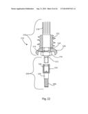 BONE COMPRESSION SCREW diagram and image