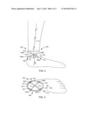 TIBIAL NERVE STIMULATION DEVICE diagram and image