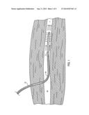 Method for Controlling Patient s Body Temperature diagram and image