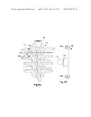 SYSTEMS AND METHODS FOR ELECTRICALLY STIMULATING PATIENT TISSUE ON OR     AROUND ONE OR MORE BONY STRUCTURES diagram and image