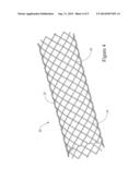 INTRODUCER SHEATH HAVING A NON-UNIFORM INNER SURFACE diagram and image