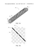 METHODS OF SUPPORTING A VEIN diagram and image