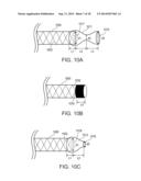 METHODS OF SUPPORTING A VEIN diagram and image