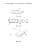 METHODS OF SUPPORTING A VEIN diagram and image