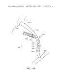 METHODS OF SUPPORTING A VEIN diagram and image