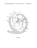 PROSTHETIC VALVE WITH ANTI-PIVOTING MECHANISM diagram and image