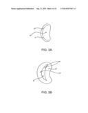 PROSTHETIC VALVE WITH ANTI-PIVOTING MECHANISM diagram and image