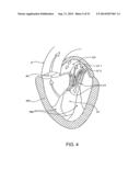 PROSTHETIC VALVE WITH ANTI-PIVOTING MECHANISM diagram and image